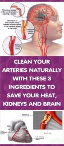 How to clean out plaque in arteries - 3 ingredients mixture