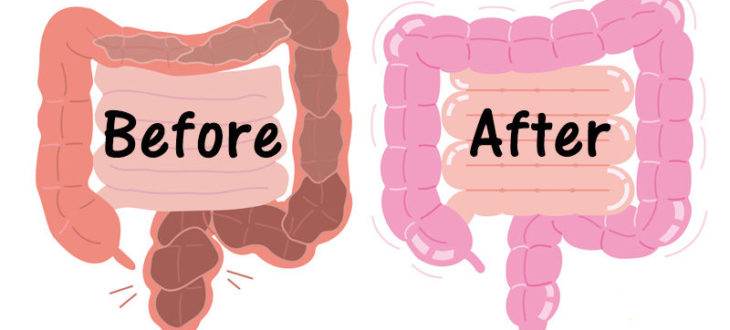 Cleanse your colon and lose 20 pounds in 3 weeks