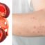 If Your Kidney Is in Danger, the Body Will Give You These 8 Signs!