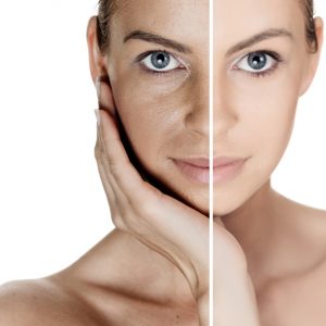 remove-acne-black-spots-dark-spots
