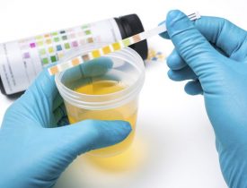 What the color of your urine and frequent urination can tell you about your health?