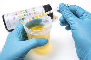 What the color of your urine and frequent urination can tell you about your health?