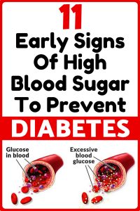 We have been hearing people complaining about having low blood sugar and some of us have experienced it ourselves. It is also an issue that it can cause a large variety of symptoms and, if becomes a regular thing it may be a sign of a serious health issue. But, high blood sugar is also something that people fear a lot. 