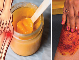 People Go Crazy For This Recipe! It Heals Knee, Bone and Joint Pain