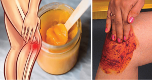 People Go Crazy For This Recipe! It Heals Knee, Bone and Joint Pain