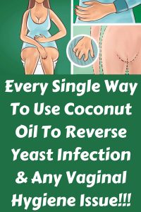 The coconut oil was making its way onto the radars of more and more persons, and as its popularity grows it also appears to grow in its abilities. It has a large number of different uses from skincare to cooking to health. It improves your health and fight against yeast infection.