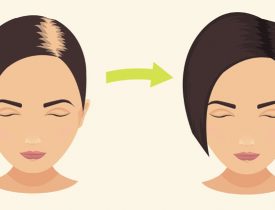 Baking Soda Shampoo: It Will Make Your Hair Grow Faster Than Ever