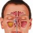 Sinus Infection Treatment: 10 Home Remedies
