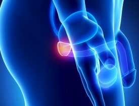 12 Early Warning Signs Of Prostate Cancer That Every Guy Needs To Know!